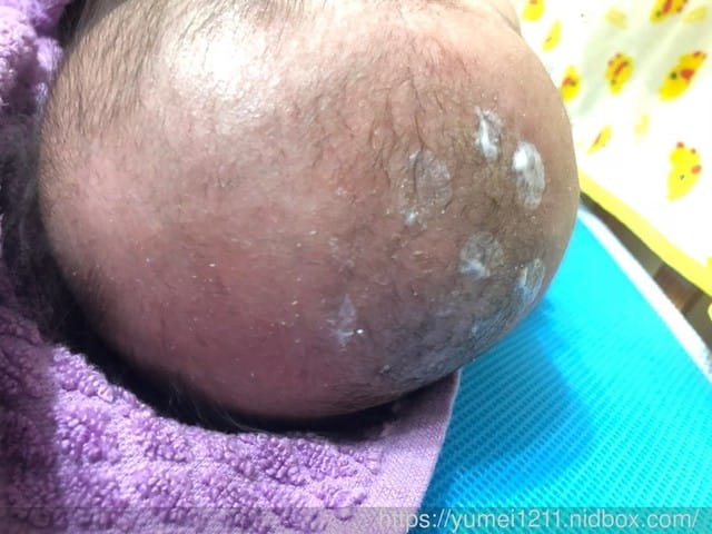 *好物分享*【慕之恬廊-寶寶頭皮調理霜&潔髮慕斯】 - 第9張圖 ../pic0.nidbox.net/56/1538532707_bea21ec5_56.jpg