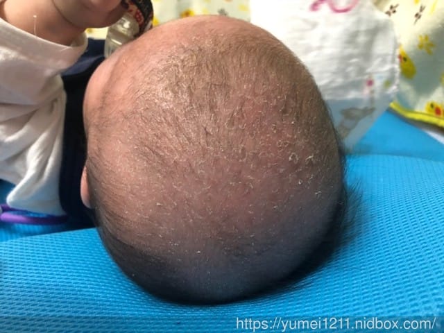 *好物分享*【慕之恬廊-寶寶頭皮調理霜&潔髮慕斯】 - 第17張圖 ../pic0.nidbox.net/56/1538558219_4dcabac3_56.jpg