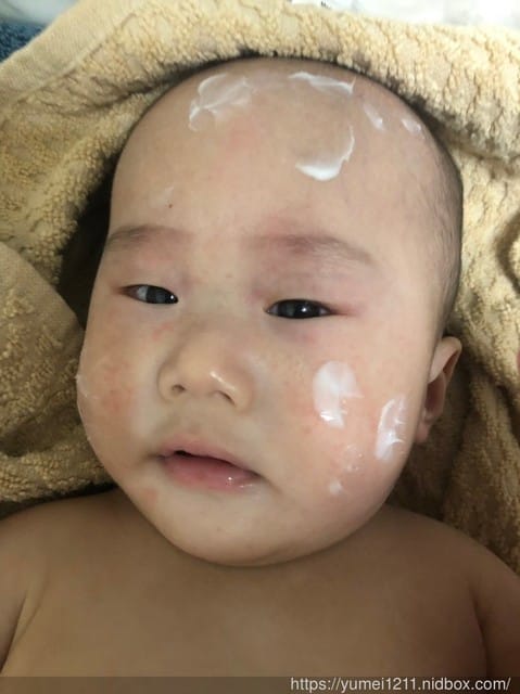 *好物分享*【LumiHerba 舒敏β修護霜,孕婦寶寶皆可使用。舒敏修護霜高度親膚性!】 - 第20張圖 *好物分享*【LumiHerba 舒敏β修護霜,孕婦寶寶皆可使用。舒敏修護霜高度親膚性!】