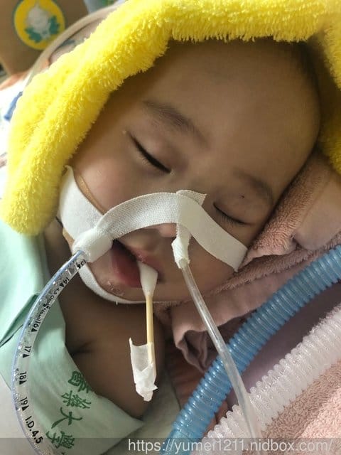 咻咻咻聲不注意、感冒遲遲不好，小心引起肺炎併發呼吸道窘迫症