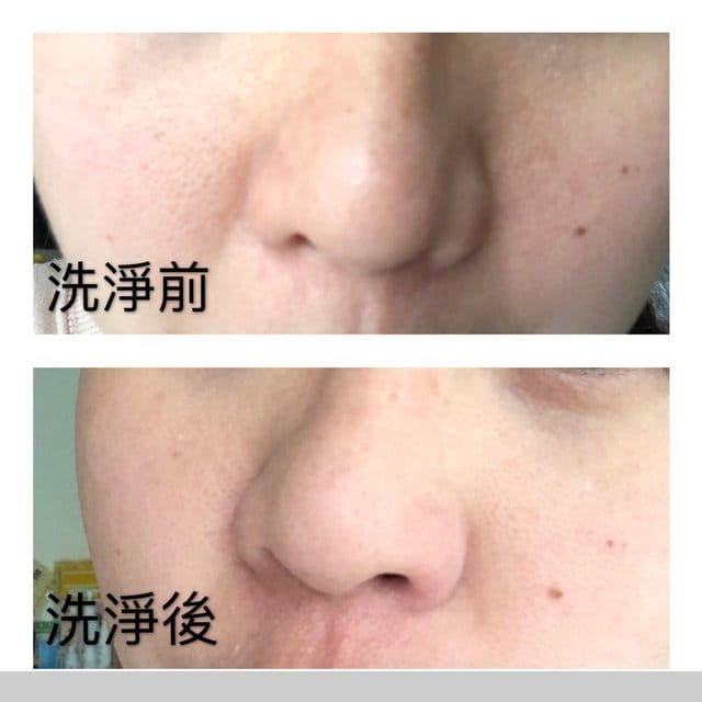 【輕熟齡全新保養術!施特佩洗卸敷角質淨化海泥】 - 第15張圖 【輕熟齡全新保養術!施特佩洗卸敷角質淨化海泥】