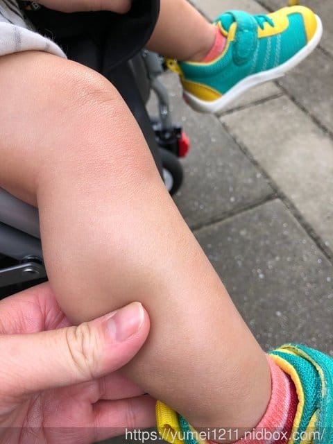 【德國-施巴5.5嬰幼兒防曬乳SPF50,Baby防曬比我們想像的更加重要!】 - 第13張圖 【德國-施巴5.5嬰幼兒防曬乳SPF50,Baby防曬比我們想像的更加重要!】